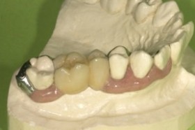 図1