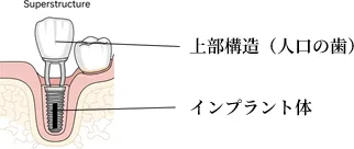 イメージ図