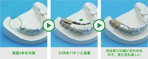 3DR