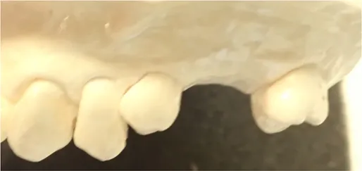 側面