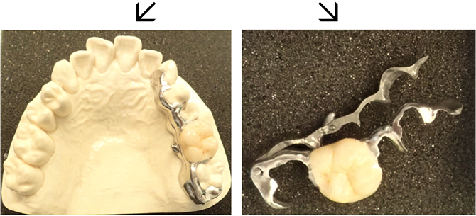 3DR義歯の特徴