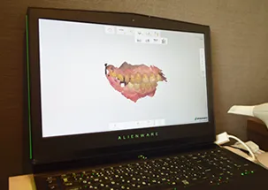 CARESシステム